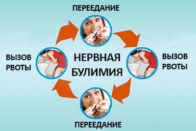 Лечение булимии в Сатке